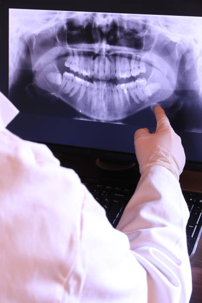 Best Root Canal Emergency Dentist  in Roseto, PA